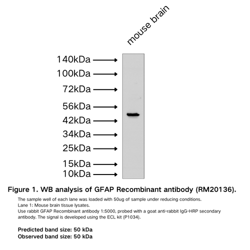 GFAP Recombinant antibody